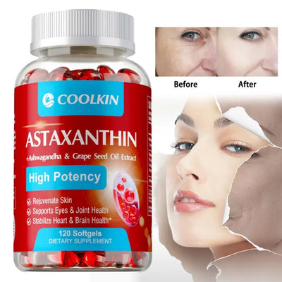 Astaxanthin 24mg - Promotes Skin Hydration and Firmness, Supports Heart, Joint and Immune System Health, Antioxidant Amazondiabacai