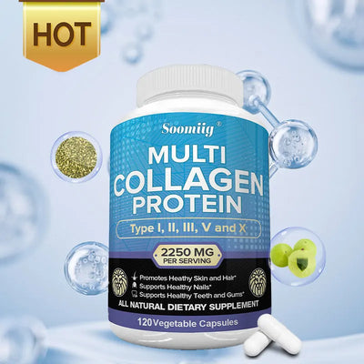 Collagen Peptides Capsules - Multi-Collagen Protein - for Hair Skin Nails Teeth Gums Joints, Gluten Free, Non-GMO Amazondiabacai